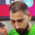 Donnarumma le visage en sang ©Ligue 1