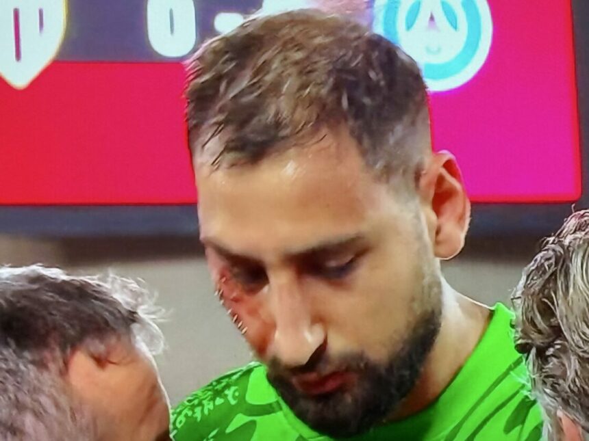 Donnarumma le visage en sang ©Ligue 1